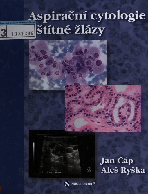 Aspirační cytologie štítné žlázy