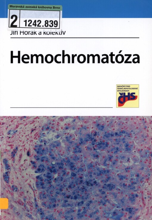 Hemochromatóza