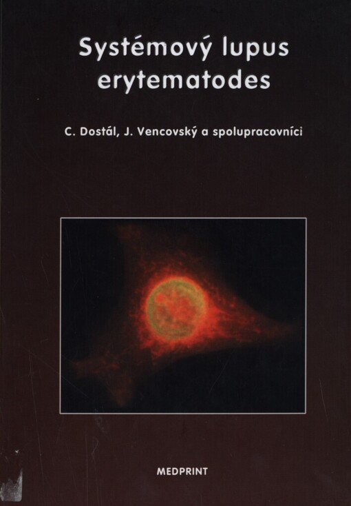 Systémový lupus erytematodes