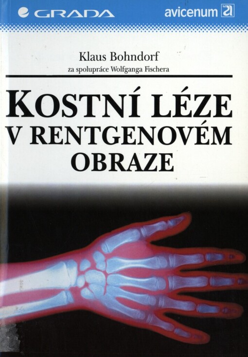 Kostní léze v rentgenovém obraze