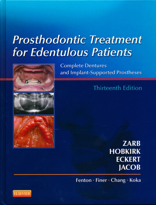 Prosthodontic treatment for edentulous patients : complete dentures and implant-supported prostheses