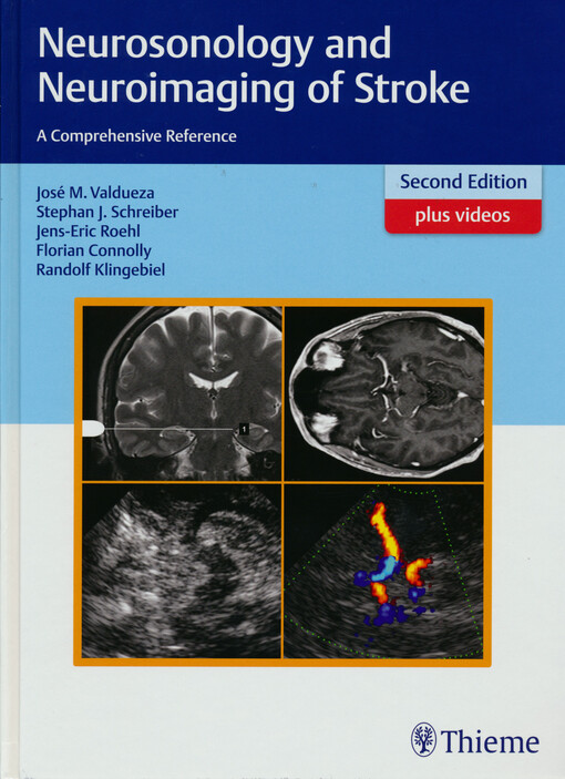 Neurosonology and neuroimaging of stroke : a comprehensive reference