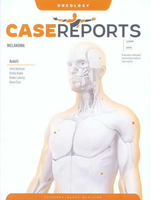 Case reports melanoma