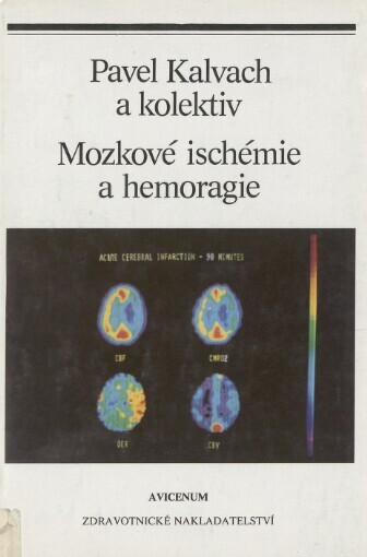Mozkové ischemie a hemoragie