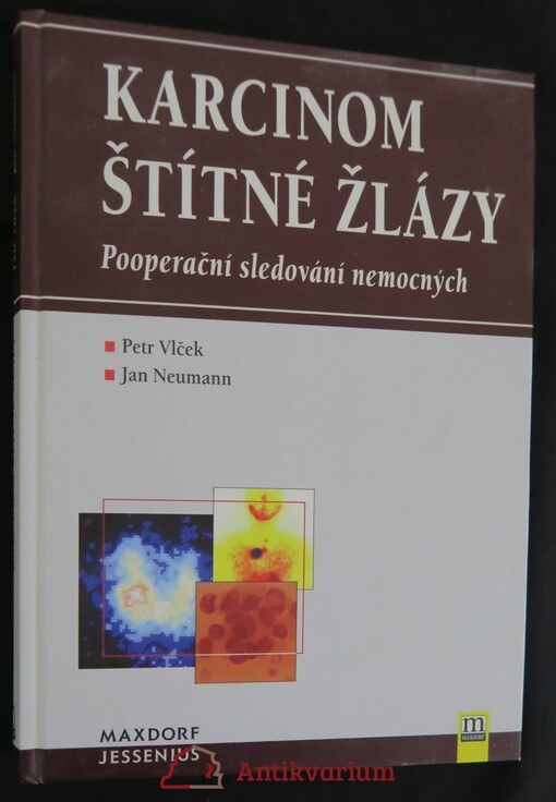 Karcinom štítné žlázy: pooperační sledování nemocných
