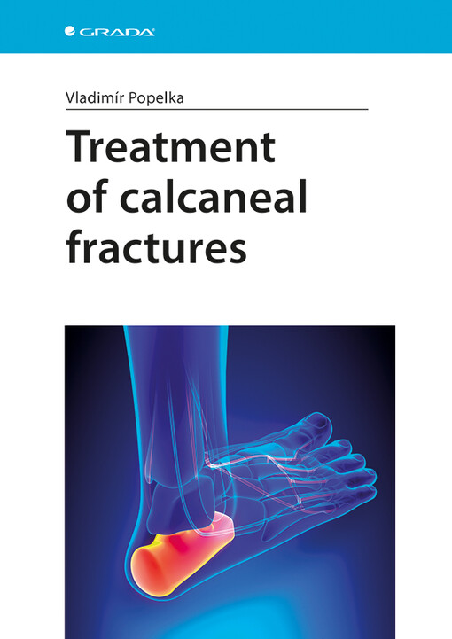 Treatment of calcaneal fractures | Popelka Vladimír - e-kniha