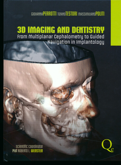 3D imaging and dentistry : from multiplanar cephalometry to guided navigation in implantology