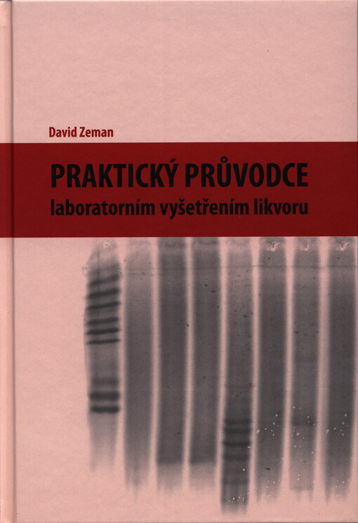 Praktický průvodce laboratorním vyšetřením likvoru