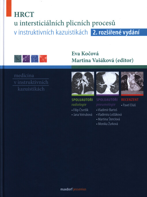 HRCT u intersticiálních plicních procesů v instruktivních kazuistikách