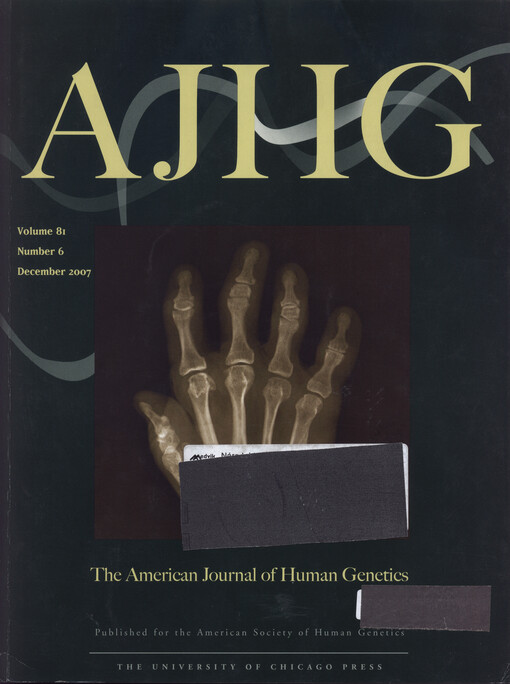 American journal of human genetics : a record of research, reviews and bibliographic material relating to heredity