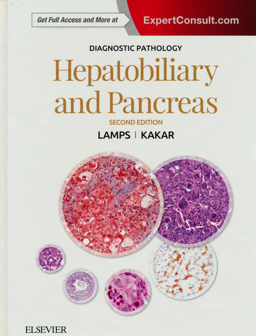 Hepatobiliary and pancreas