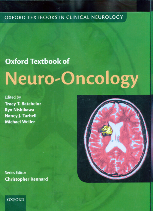 Oxford textbook of neuro-oncology