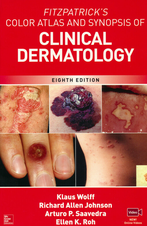 Fitzpatrick's color atlas and synopsis of clinical dermatology