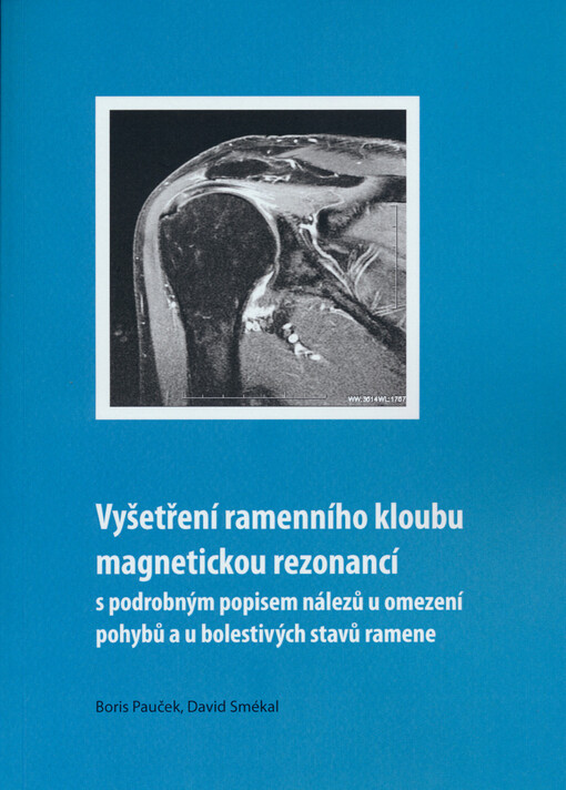 Vyšetření ramenního kloubu magnetickou rezonancí : s podrobným popisem nálezů u omezení pohybů a u bolestivých stavů ramene
