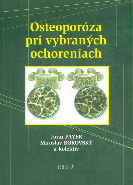 Osteoporóza pri vybraných ochoreniach /Juraj Payer, Miroslav Borovský a kolektív