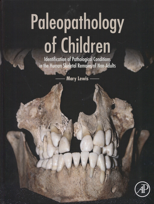 Paleopathology of children : identification of pathological conditions in the human skeletal remains of non-adults