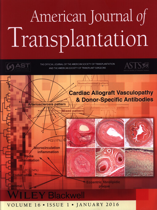 American journal of transplantation