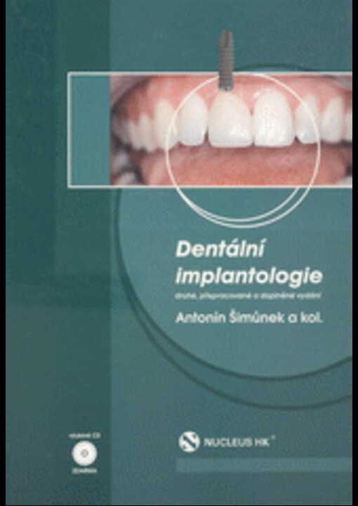 Dentální implantologie