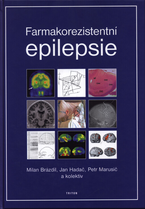 Farmakorezistentní epilepsie