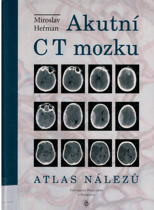 Akutní CT mozku: atlas nálezů