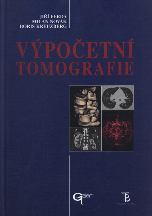 Výpočetní tomografie