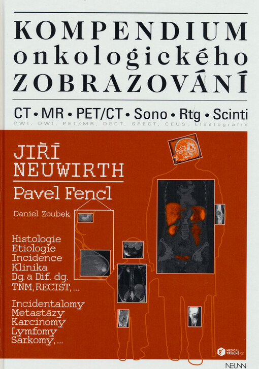 Kompendium onkologického zobrazování