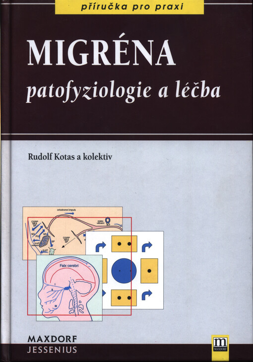 Migréna : patofyziologie a léčba