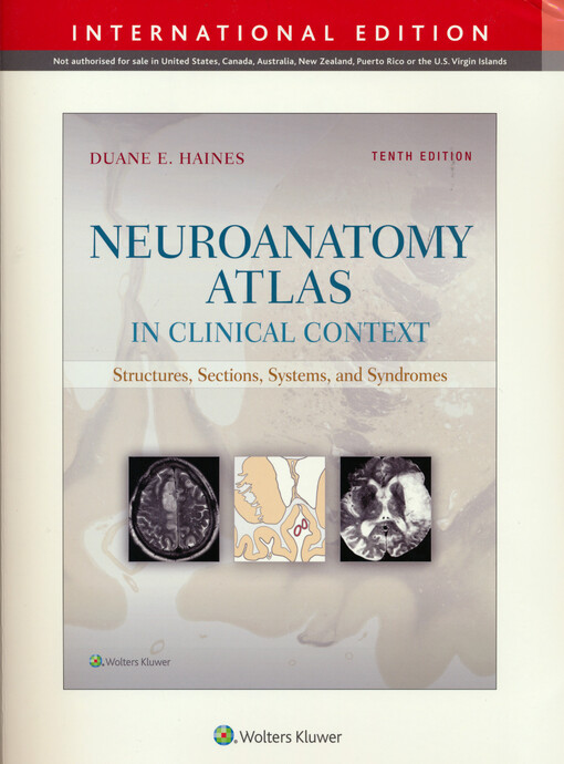 Neuroanatomy atlas in clinical context : structures, sections, systems, and syndromes