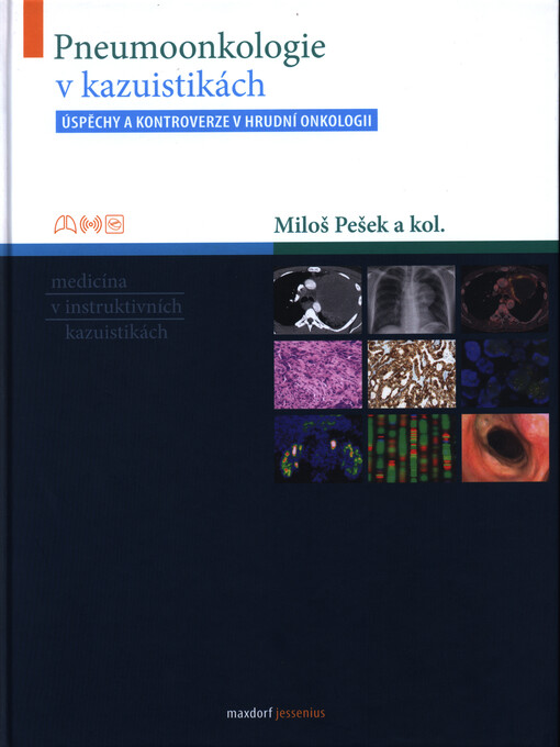 Pneumoonkologie v kazuistikách