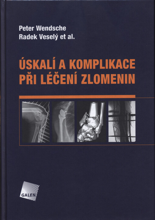 Úskalí a komplikace při léčení zlomenin