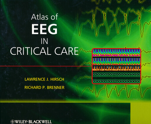 Atlas of EEG in critical care