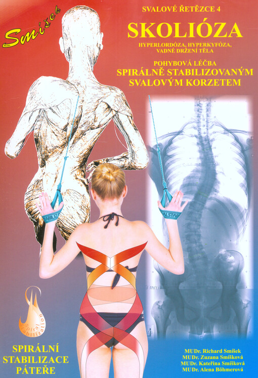 Skolióza : svalové řetězce 4 : spirální stabilizace páteře : hyperlordóza, hyperkyfóza, vadné držení těla : léčba spirálně stabilizovaným svalovým korzetem : manuální příprava, pohybová léčba skoliózy bez korzetu a operace : metoda spirální stabilizace pá