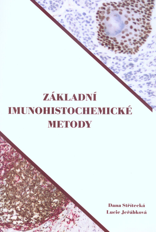Základní imunohistochemické metody