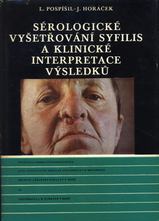 Sérologické vyšetřování syfilis a klinické interpretace výsledků =Serological examination of syphilis and clinical interpretation of the results obtained
