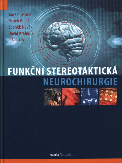 Funkční stereotaktická neurochirurgie