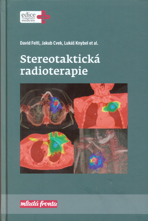Stereotaktická radioterapie