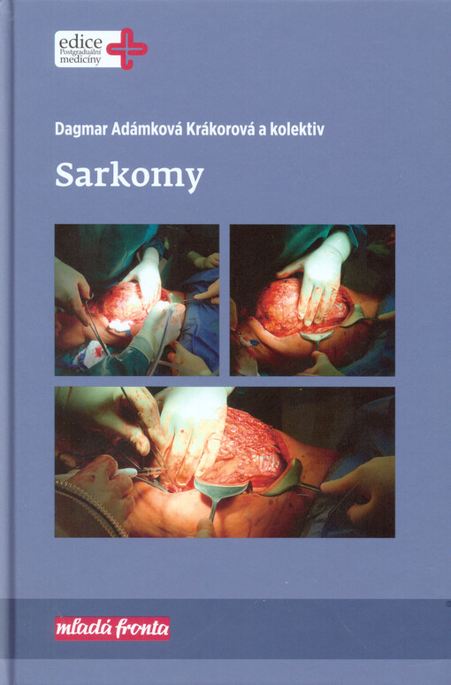 Sarkomy