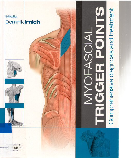 Myofascial trigger points :comprehensive diagnosis and treatment