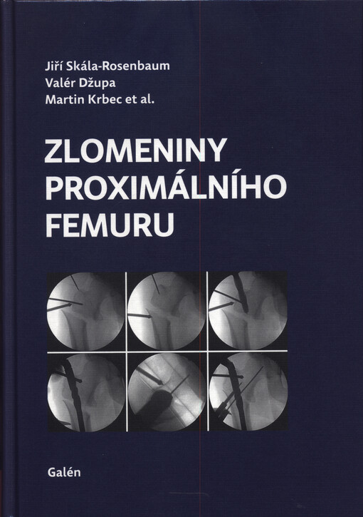 Zlomeniny proximálního femuru