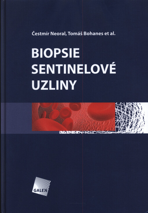 Biopsie sentinelové uzliny
