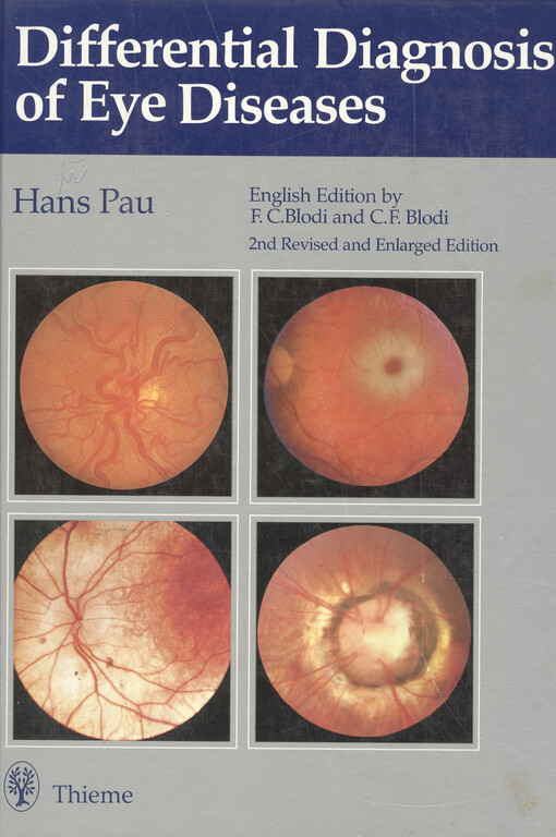 Differential diagnosis of eye diseases