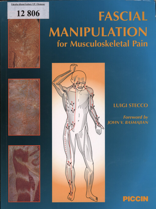 Fascial manipulation for musculoskeletal pain