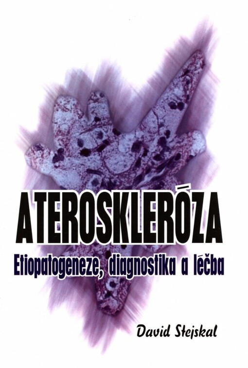 Ateroskleróza: etiopatogeneze, diagnostika a léčba