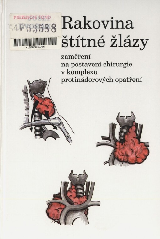 Rakovina štítné žlázy: zaměření na postavení chirurgie v komplexu protinádorových opatření