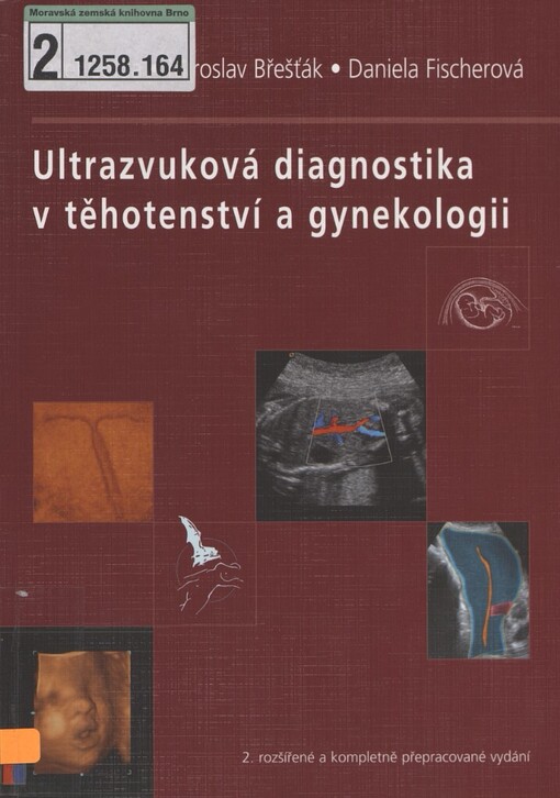 Ultrazvuková diagnostika v těhotenství a gynekologii