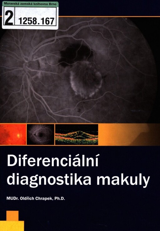 Diferenciální diagnostika makuly