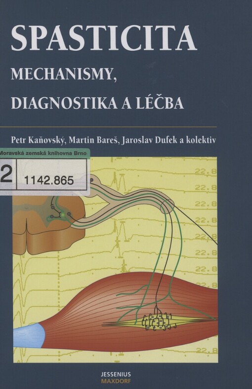 Spasticita: mechanismy, diagnostika, léčba