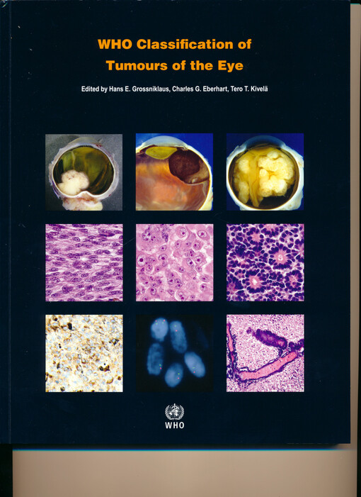 WHO classification of tumours of the eye