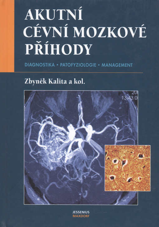 Akutní cévní mozkové příhody : diagnostika, patofyziologie, management
