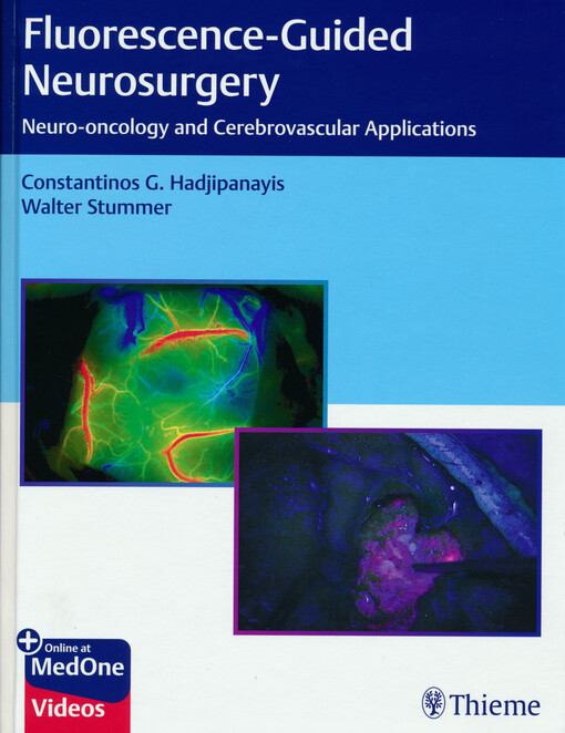 Fluorescence-guided neurosurgery : neuro-oncology and cerebrovascular applications